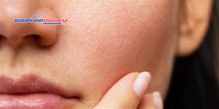 Bút Đo pH Trên Bề Mặt Da Người Và Da Đầu Hanna HI981037 Bút Đo pH Trên Bề Mặt Da Người Và Da Đầu Hanna HI981037